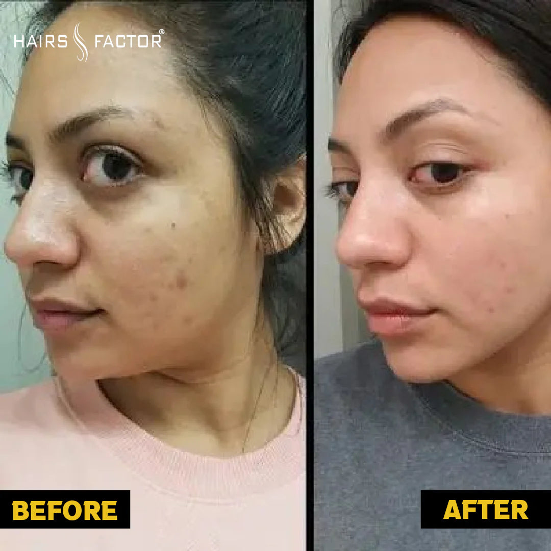 Zafrani Cream – Pure Saffron Formula for Radiant Skin 100% Result